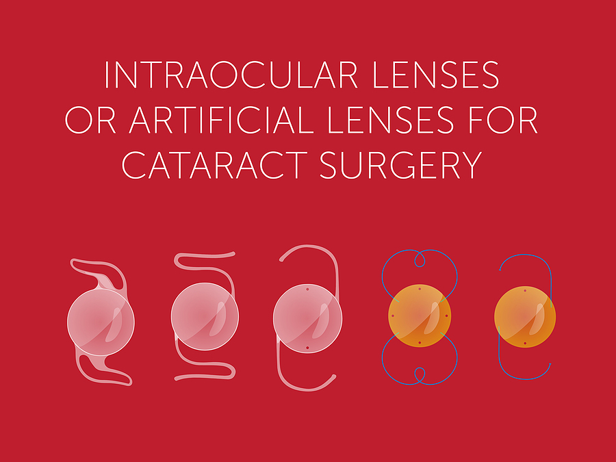 Multifocal IOLs