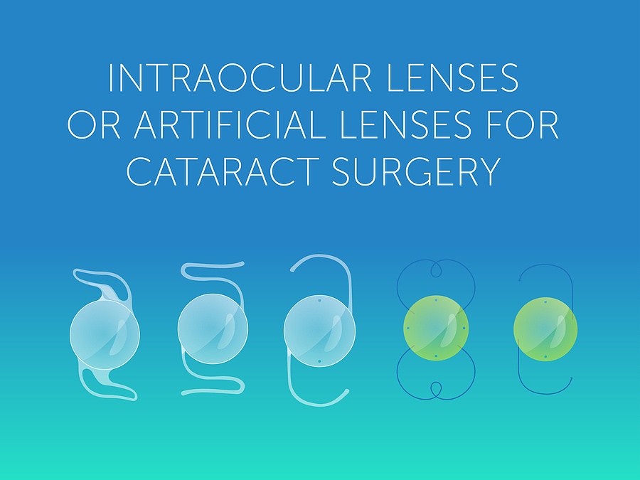 Intraocular Lenses For Cataracts